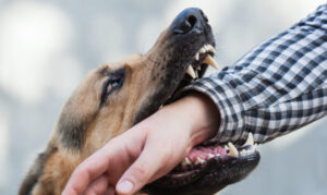 Why Choose Farmer, Cline & Campbell Personal Injury Lawyers for Your Dog Bite Case in Beckley? 